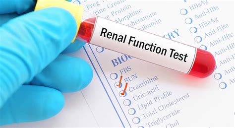 test for kidney function